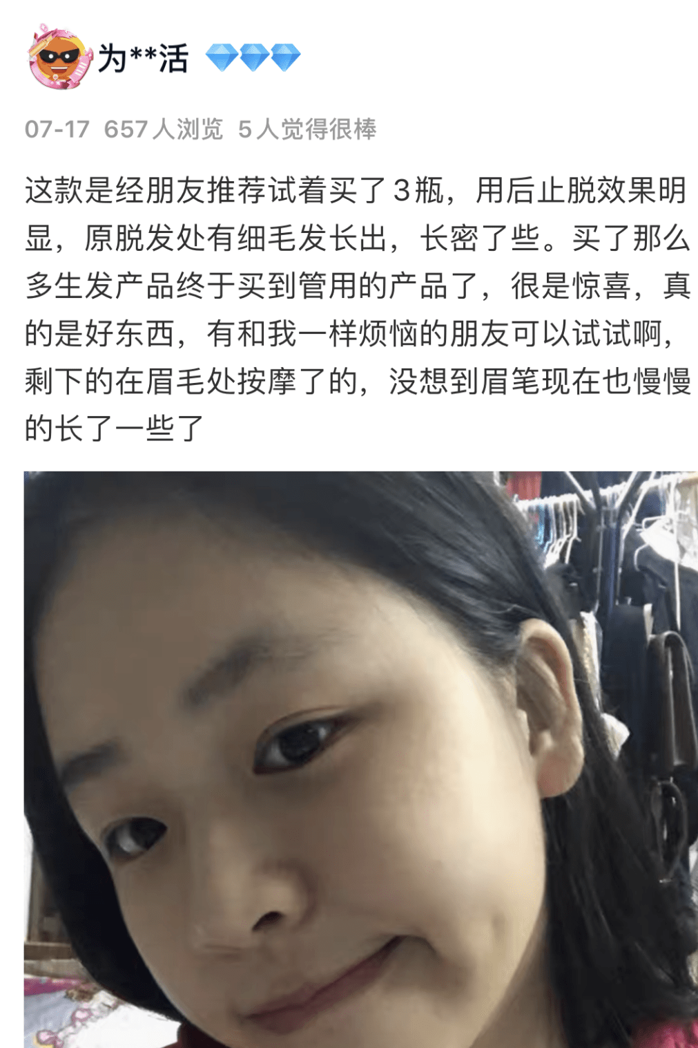 毛囊|流女星们的“狮子头”都是假象？录节目竟然当场掉下假发片，真相竟然是……