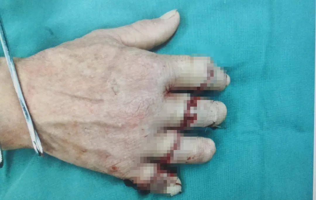 什么人用一根指头和面 d712360966394aa9a9e77ff010e4230d.jpeg