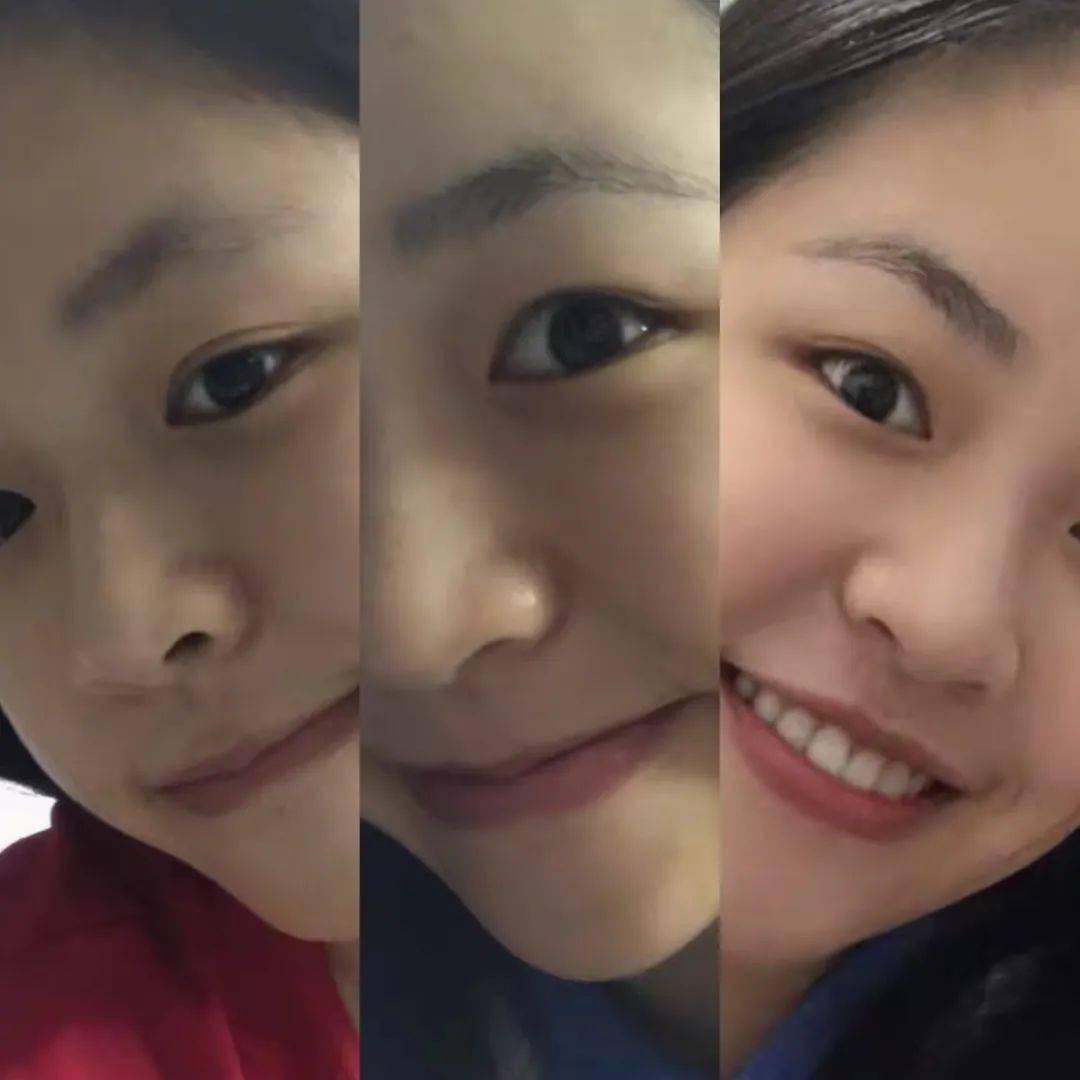 毛囊|流女星们的“狮子头”都是假象？录节目竟然当场掉下假发片，真相竟然是……