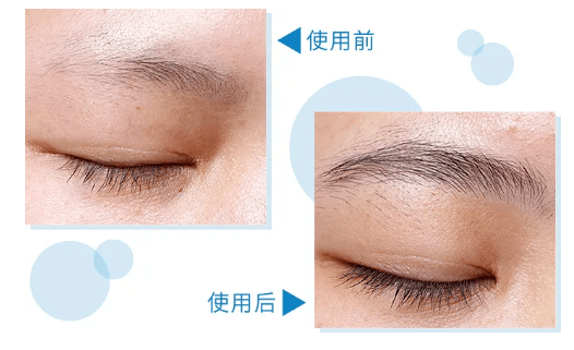 毛囊|流女星们的“狮子头”都是假象？录节目竟然当场掉下假发片，真相竟然是……