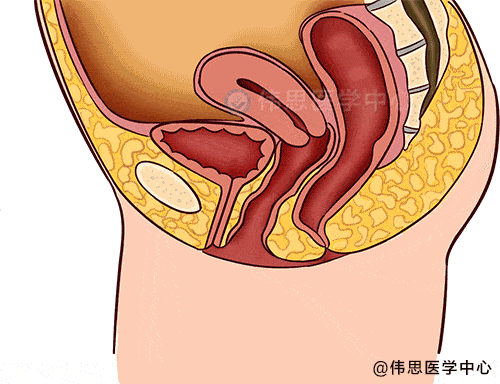 阴道后壁膨出,主要导致便秘,排便困难阴道前壁膨出,主要引起排尿困难