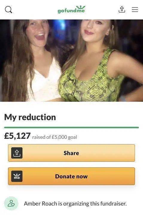 胸部|胸部自然生长到 34J，被逼众筹缩胸，胸大的烦恼她知道