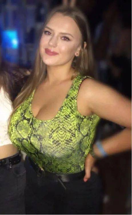 胸部|胸部自然生长到 34J，被逼众筹缩胸，胸大的烦恼她知道