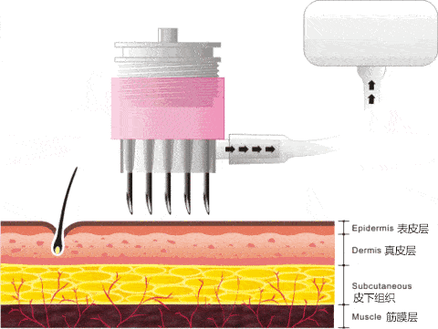 效果|她也太会玩了…