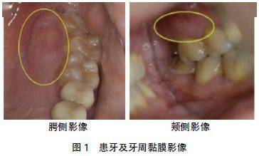 成语颌什么珠_成语故事简笔画(4)