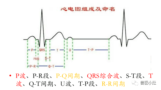 左心室肥大:r波增高,s-t段下移,qrs时限延长;心电轴偏左