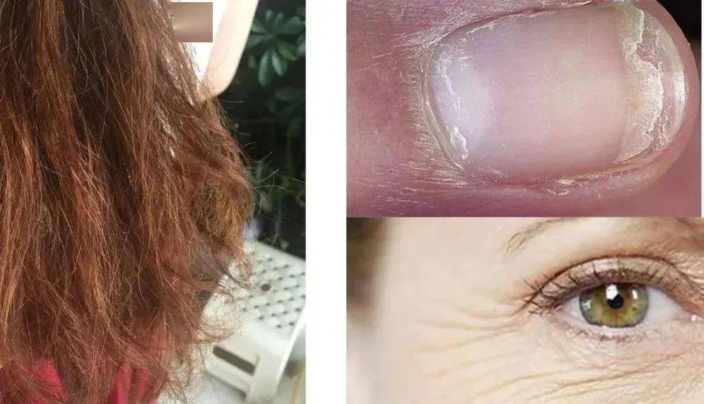 防腐剂|看得出这是40岁的年纪吗？跨越20年的逆龄秘密竟然是这？！原来吃“防腐剂”真的能长生不老？！