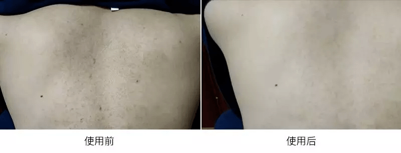 皮肤|雅顿身体乳涂一次，清爽一整天，让皮肤比丝绸还滑！全身亮成聚光灯！