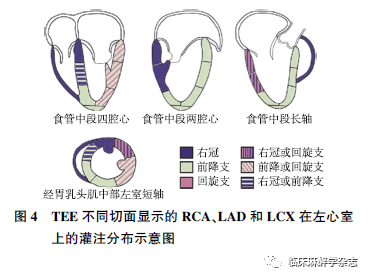 心动图|经食管超声心动图在非心脏手术中应用专家共识 （2020版）