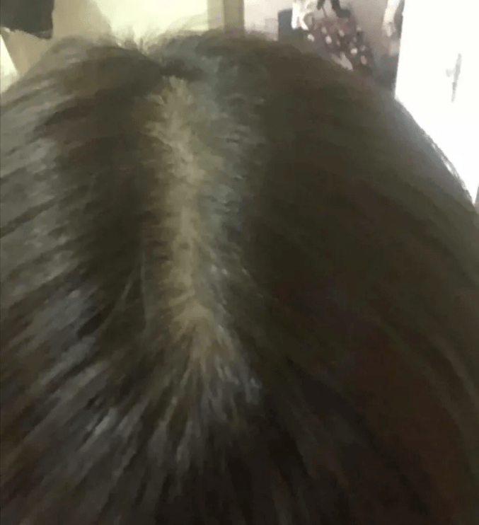 ta|十斤黑芝麻都比上2颗ta！风靡美国的这颗糖把头发越吃越密，皮肤也变好了，感觉年轻10多岁！