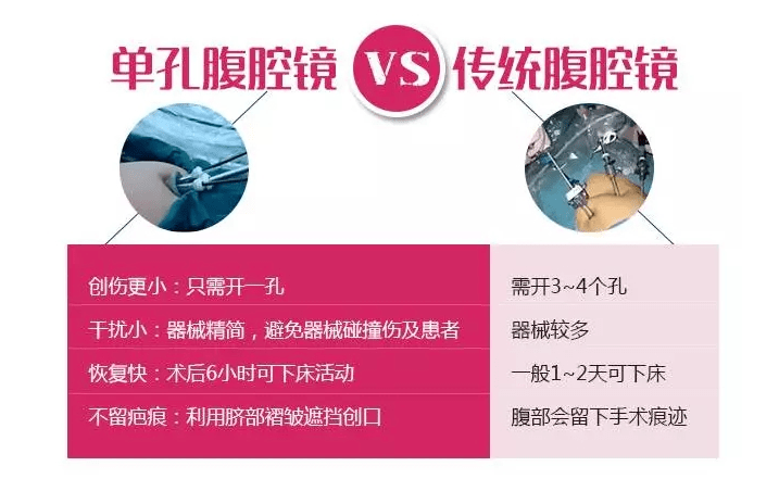 从微创到无痕县人民医院成功开展桃江首例单孔腹腔镜手术