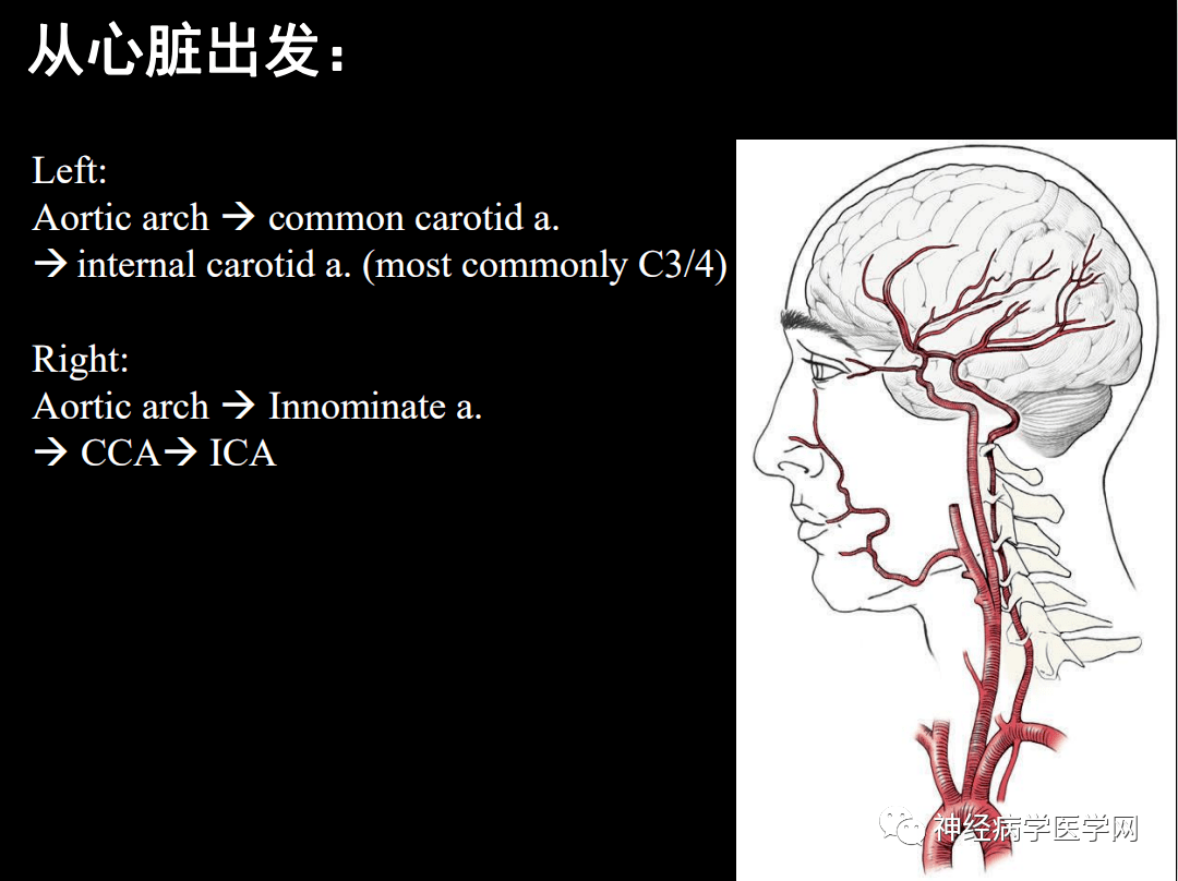 脑血管之当解剖遇到临床_手机搜狐网