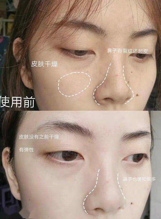 肌肤|嫩到掐出水！用一次比敷100片面膜还白润，10分钟感受女星同款水光肌！