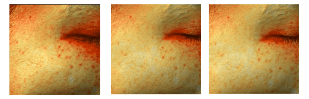 小土|黑黄皮逆袭！IU从“小土妹”到“白雪公主”，靠的竟然是它？！