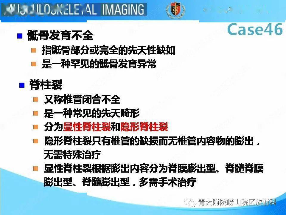 尾部退化综合征