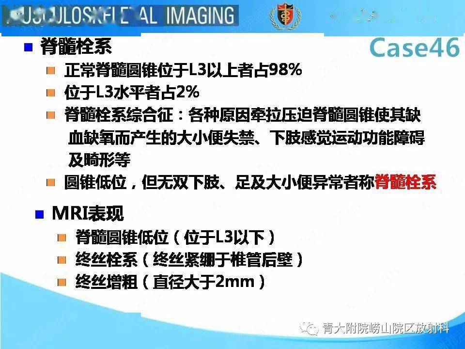 尾部退化综合征