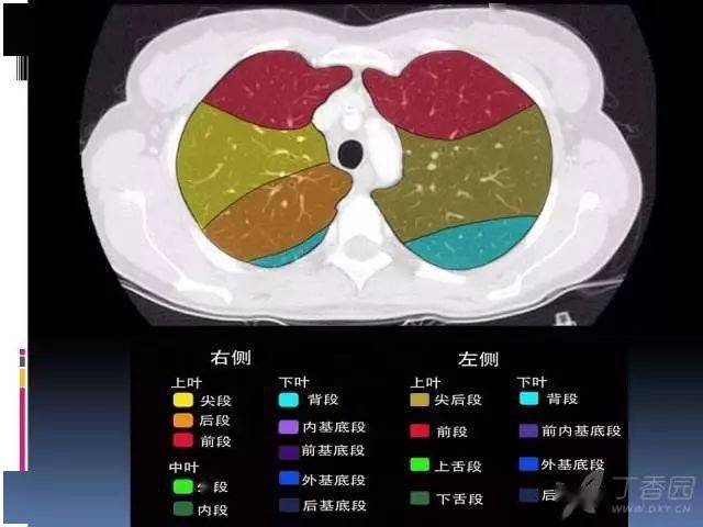 ct入门:肺叶分段,支气管,肺动脉 ct 图谱全在这