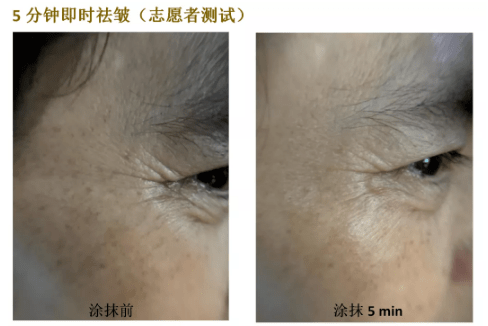 近照|曾经红极一时的“最美港姐”近照曝光，原来美人真的能被一个细节毁掉.......