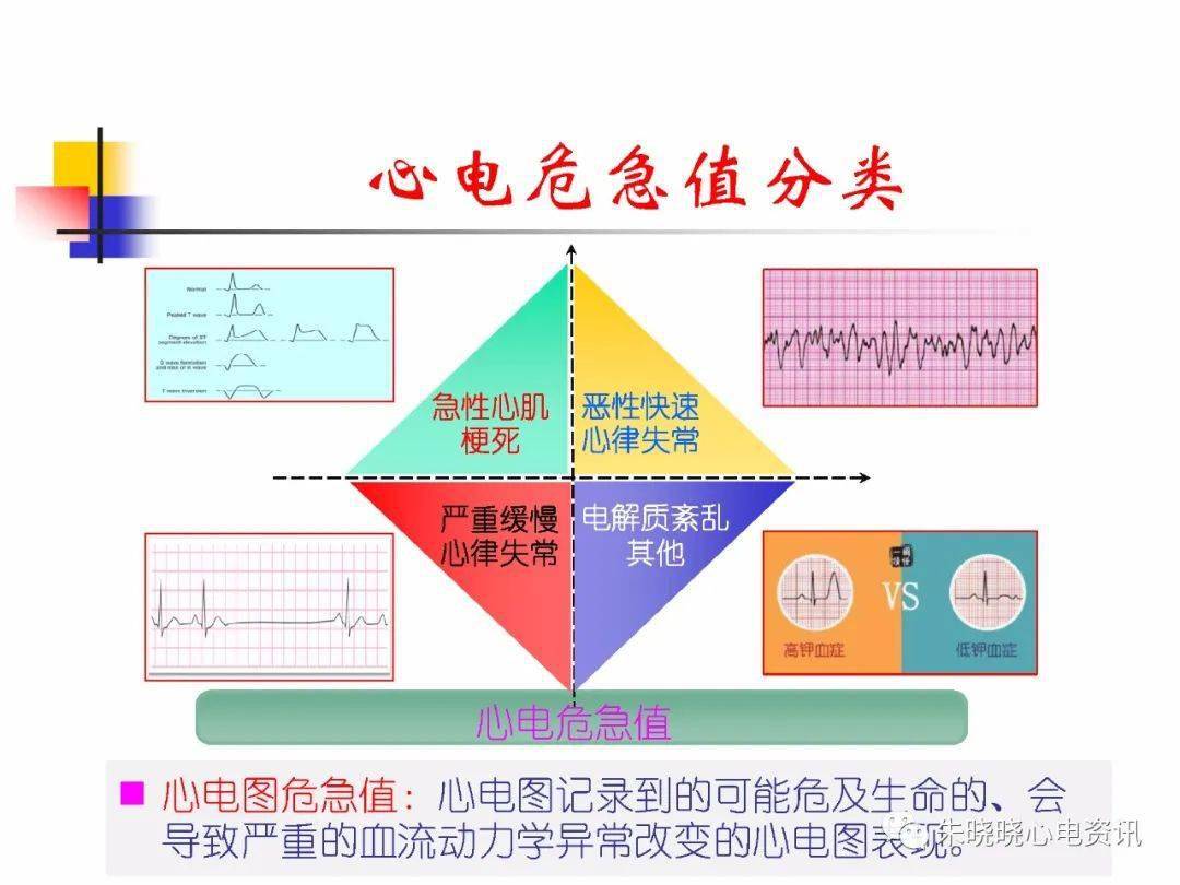 心电图危急值识别与处理