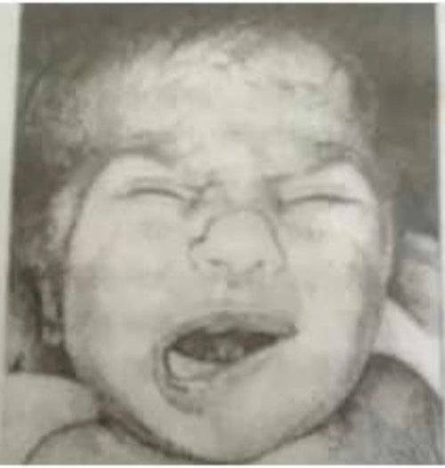 什么是特殊面容宝宝 531d33f007ee45fe865cb9f7377cf542.jpeg