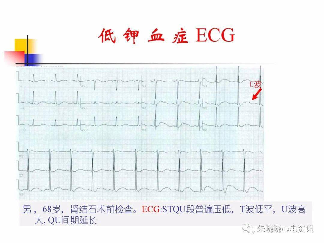 e7a28effccb547d6a8bf5eac8211fcda.jpeg