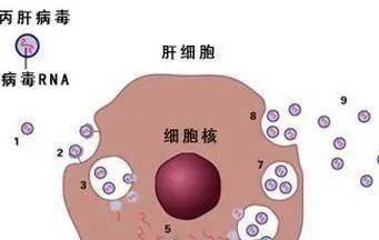 福音|丙肝患者福音：可治愈可报销！！！