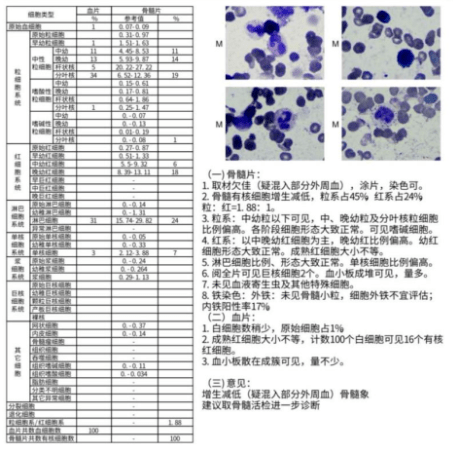 治疗|不伴有 JAK2-V617F 基因突变的原发性骨髓纤维化治疗如何选择？