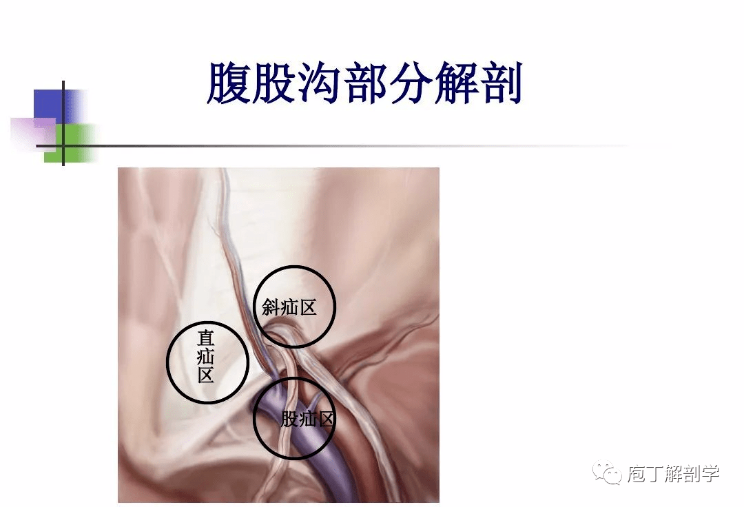 影像解剖一图读懂腹股沟区解剖