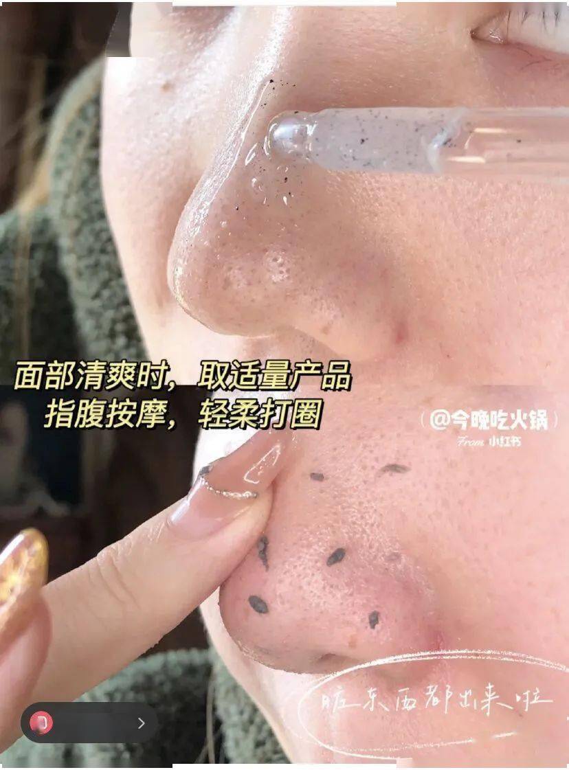 黑头|只要39元，轻松“磨皮”，让你的皮肤好到爆！