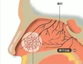 老年人口鼻出血_老年微信头像