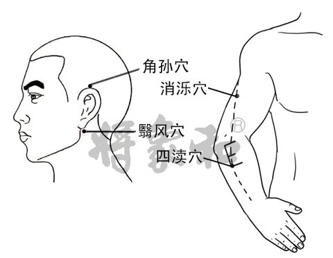 上焦火,下焦寒,根本原因在于中焦不通!