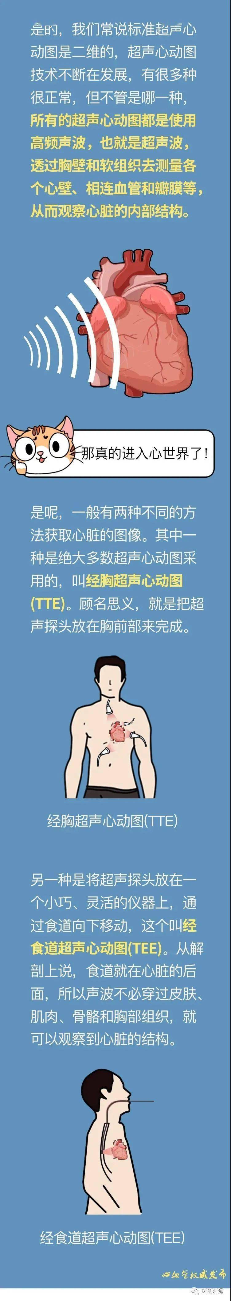 一次性搞懂超声心动图
