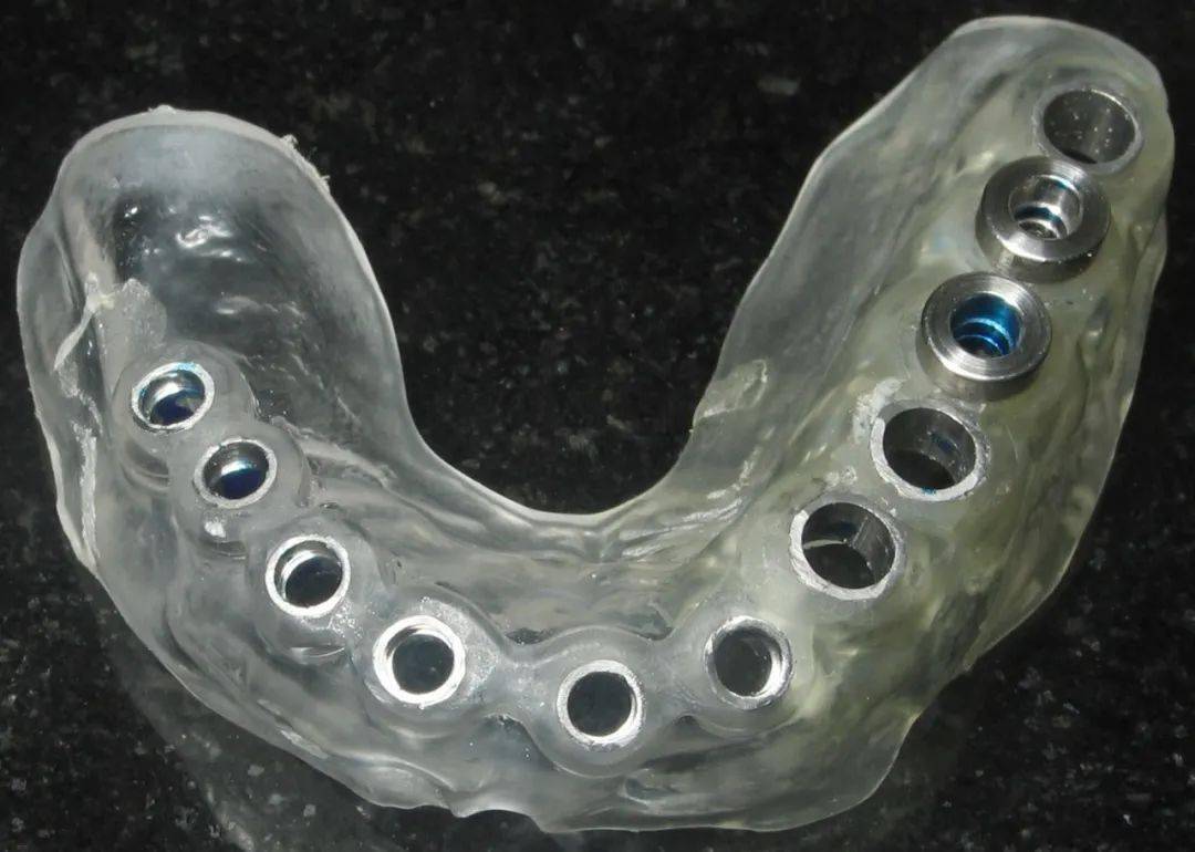 种植手术导板-瑞佳义齿