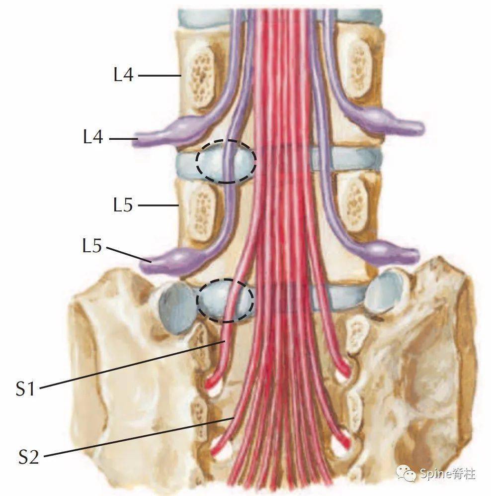 常见腰椎间盘突出与脊神经关系_手机搜狐网