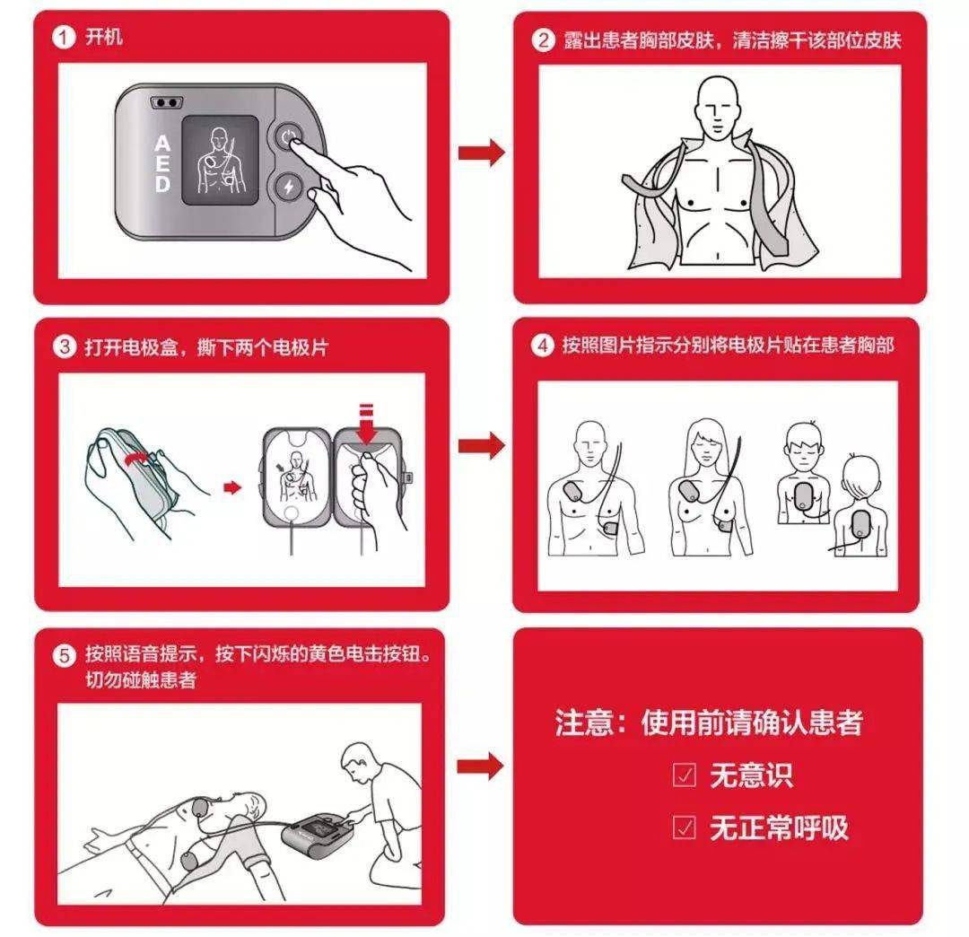 aed操作图解(图片来源于网络"不会救"与"不敢救"中国新闻周刊于