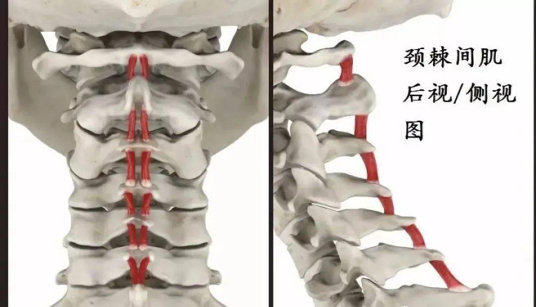 颈棘间肌二,重要图示功能:支撑和伸展脊柱.