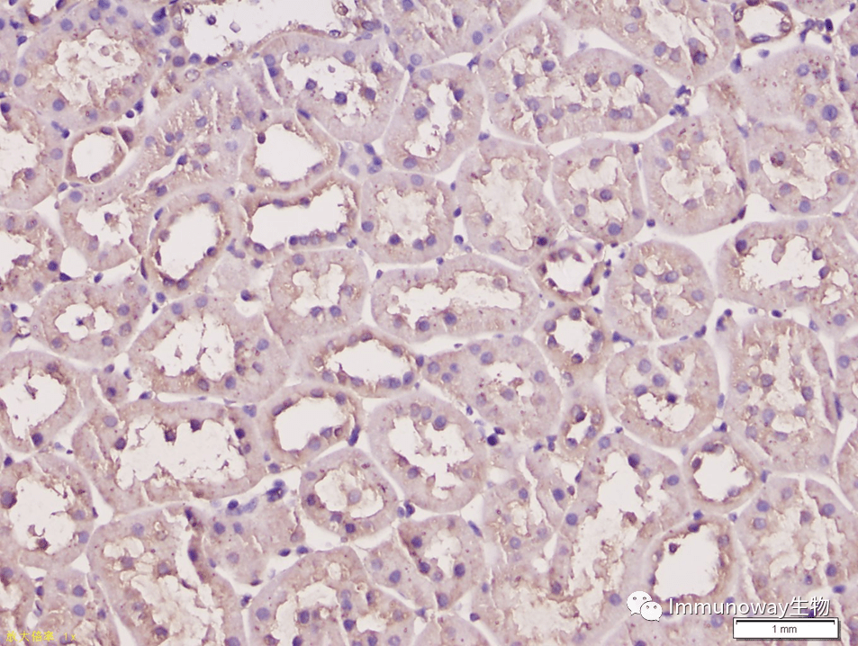 免疫组化ihc│常见问题及解析集锦