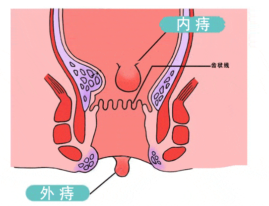 4967f2a66dcf4057b453590c565637af.gif
