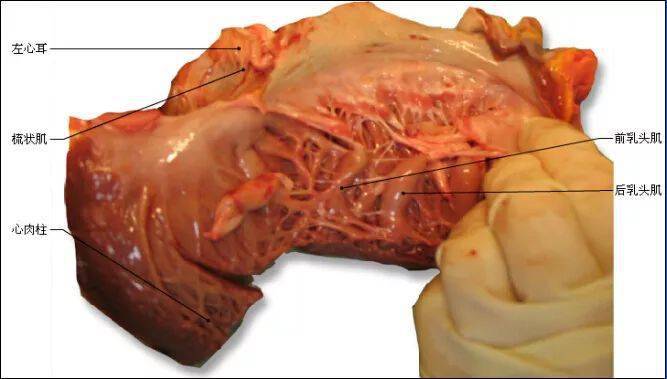 史上最全心脏解剖图!(值得收藏)