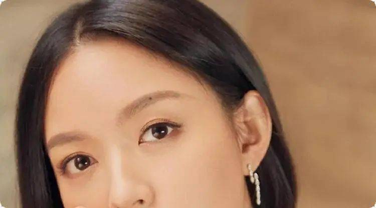 身上有"暗财痣"的人,男富女贵,衣食无忧!