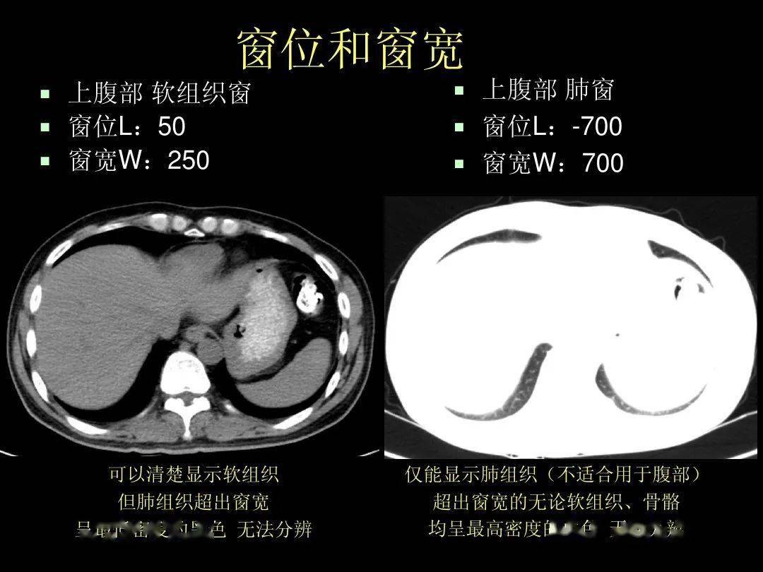 ct入门 腹部ct应用入门必备(原理 精美解剖图谱)