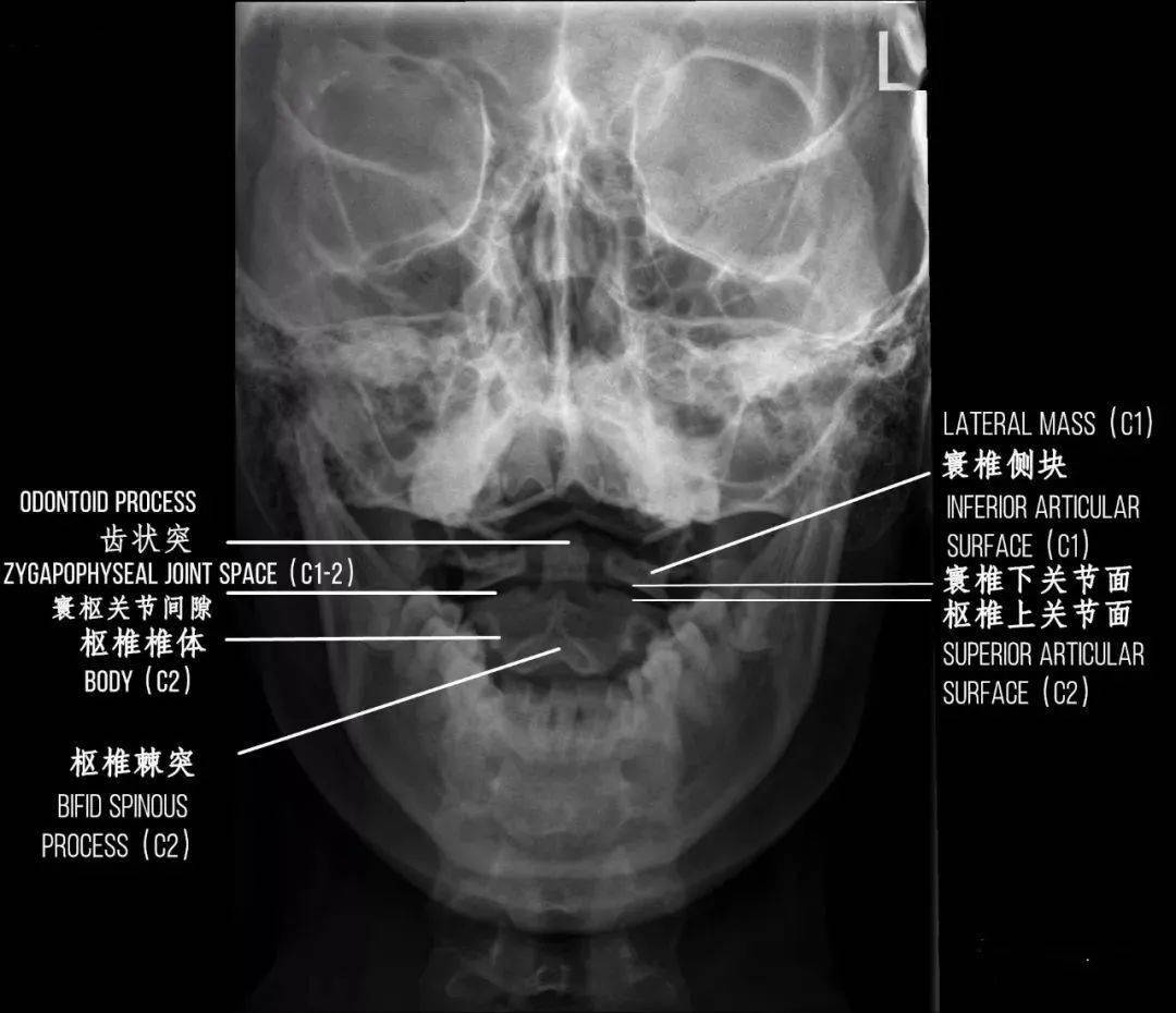 头颅MR水平位正常解剖Show_医学界-助力医生临床决策和职业成长