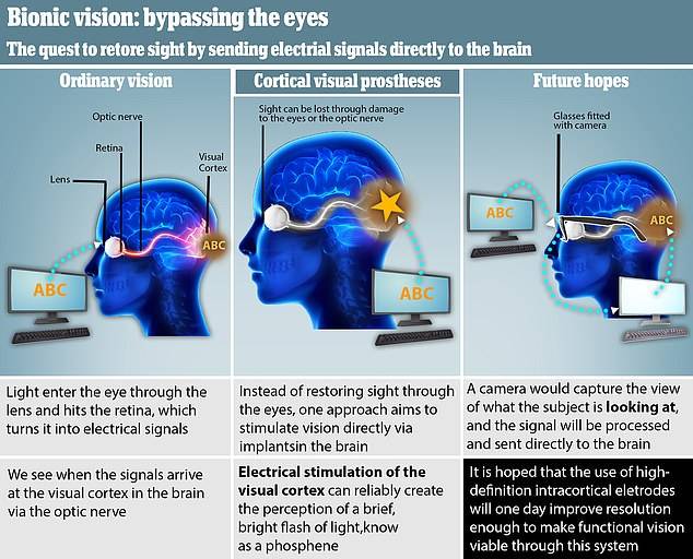 视力|大脑植入电极恢复猴子基本视力，该技术有望三年内造福盲人