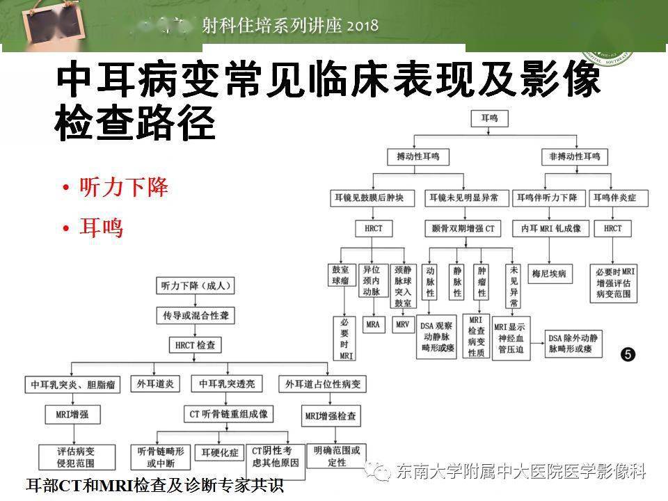 中耳解剖及中耳病变影像诊断