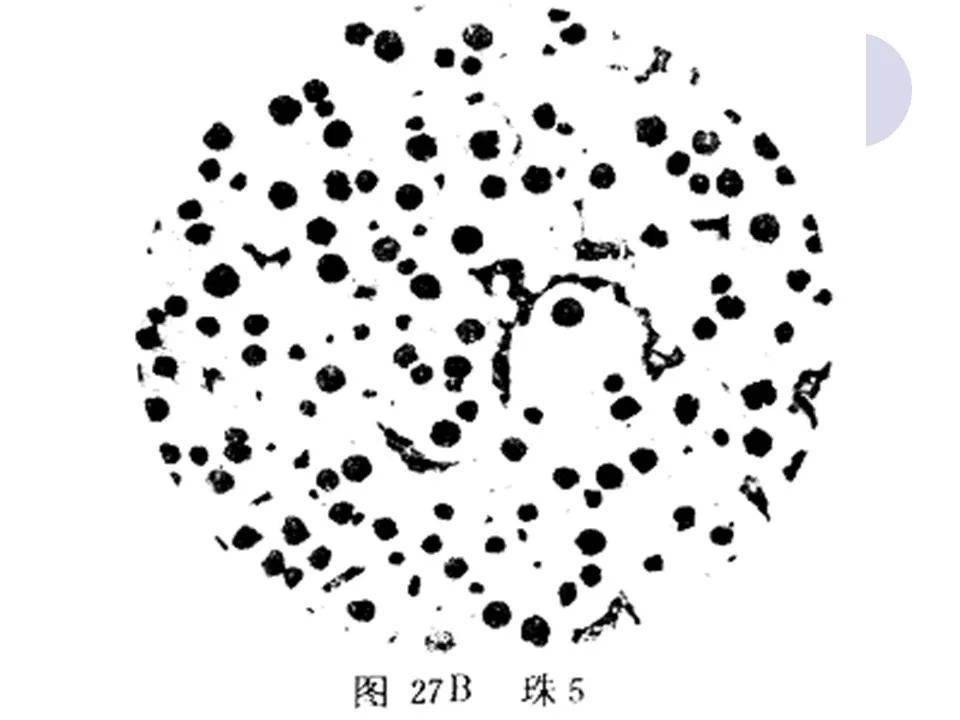 ppt:球墨铸铁与蠕墨铸铁金相图谱