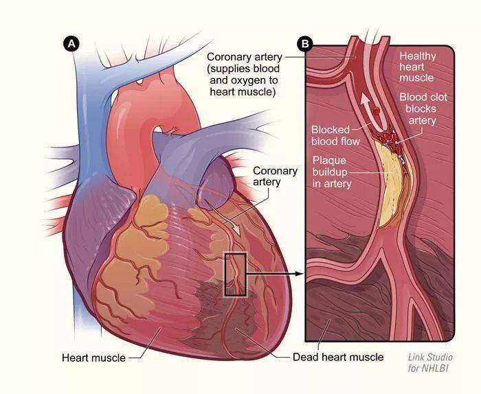 (泵; 抽送)  oxygen-rich(富氧的)  coronary arteries(冠状动脉)