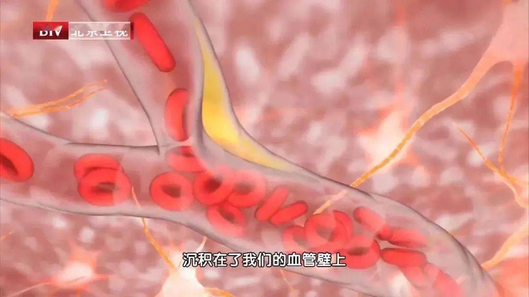 【微焦点】心跳快好还是慢好?这个范围更健康!