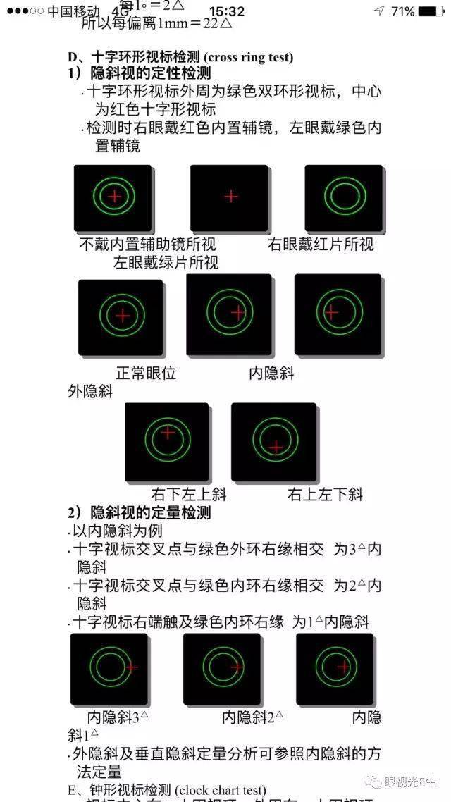 快速恢复视力训练 5524452b8dfc4ae682490d69d6aa458f.jpeg