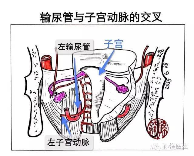 医学笔记|输尿管局部解剖中的三个"3"