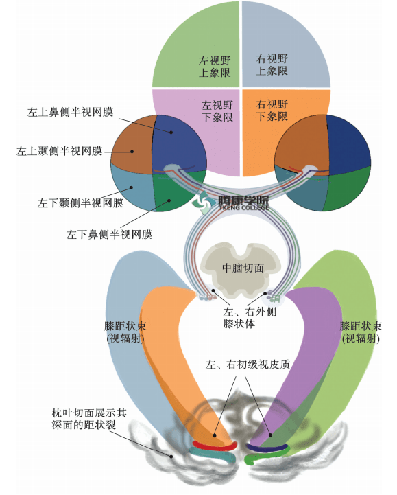 视野缺陷,中心暗点:视交叉受损所造成的双颞侧半盲.